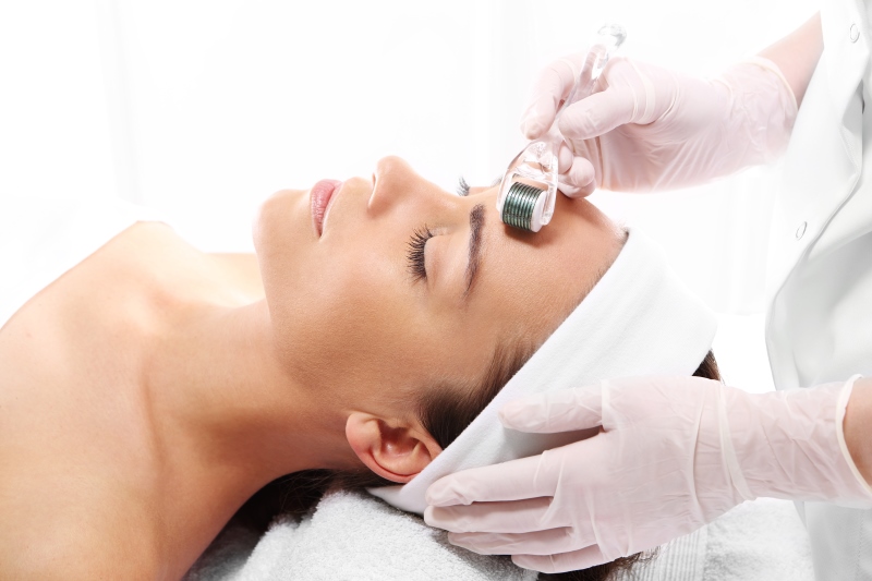 Microneedling: medicina estetica
