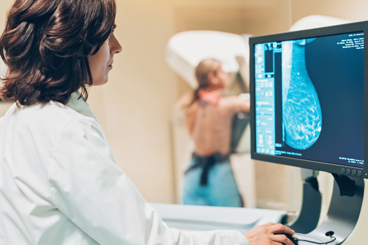 Prevenzione senologica: l’importanza della mammografia digitale