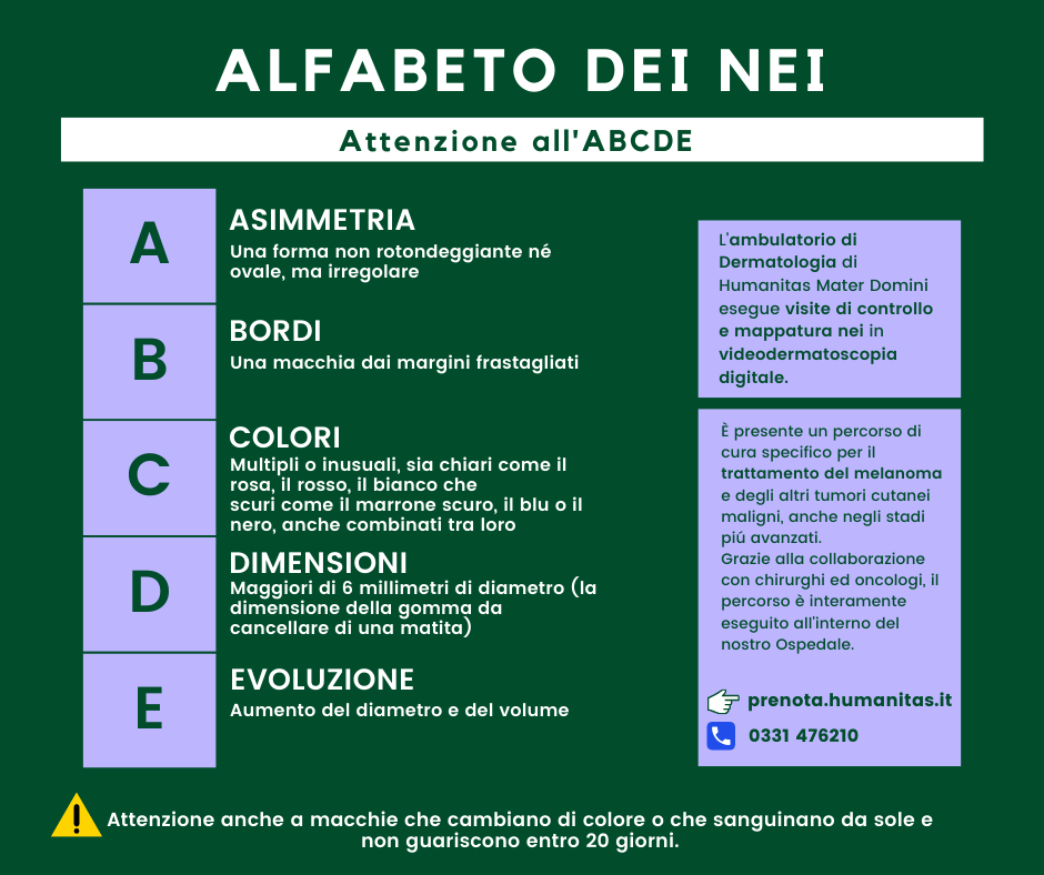 humanitas Mater Domini: “ABCDE” dell’Alfabeto dei nei (Asimmetria, Bordi irregolari, Colore variegato, Dimensioni maggiori di 6 millimetri, Evoluzione nel giro di settimane o mesi), acronimo che evidenzia le caratteristiche proprie delle formazioni sospette.