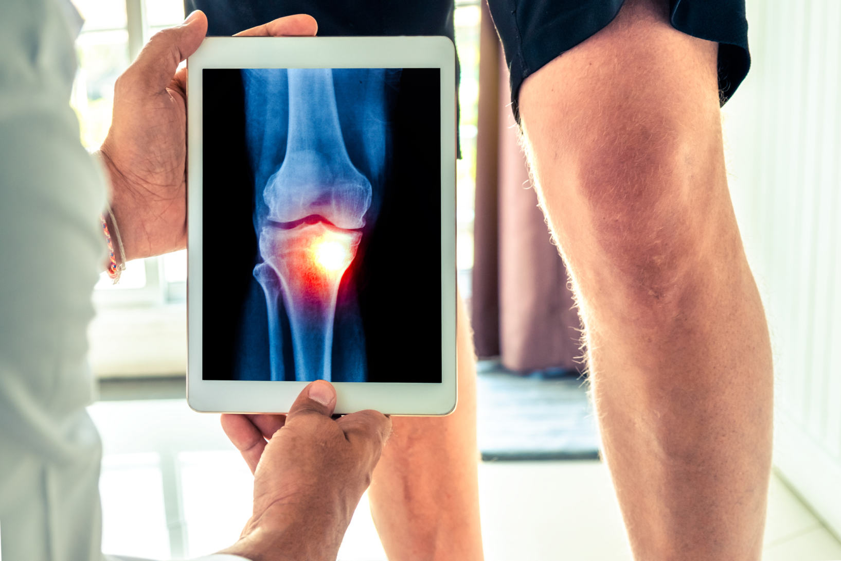 Valutazione funzionale del ginocchio: l’Intelligenza Artificiale al servizio della diagnosi