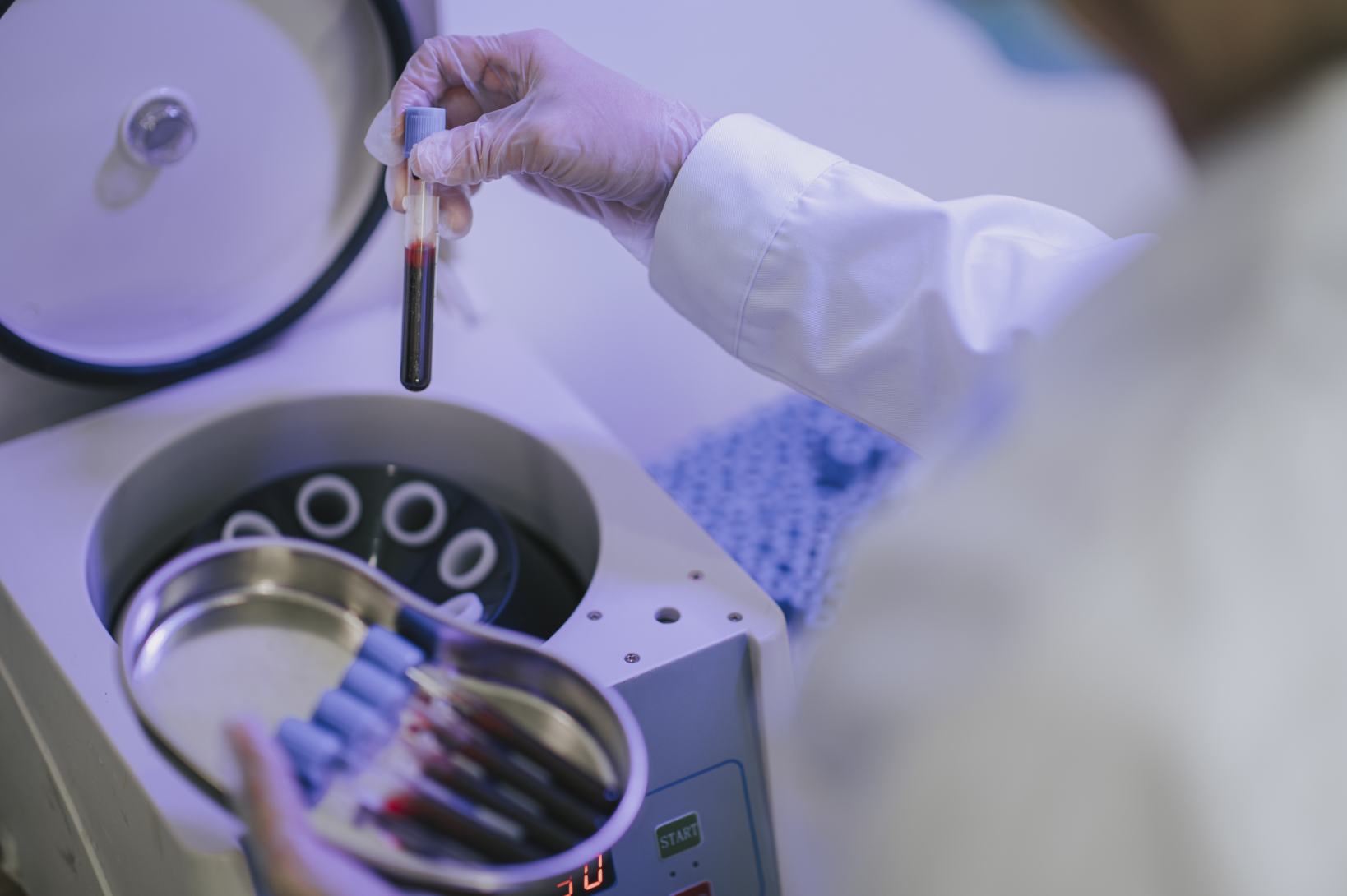 Medicina rigenerativa, in Humanitas Mater Domini il trattamento PRP