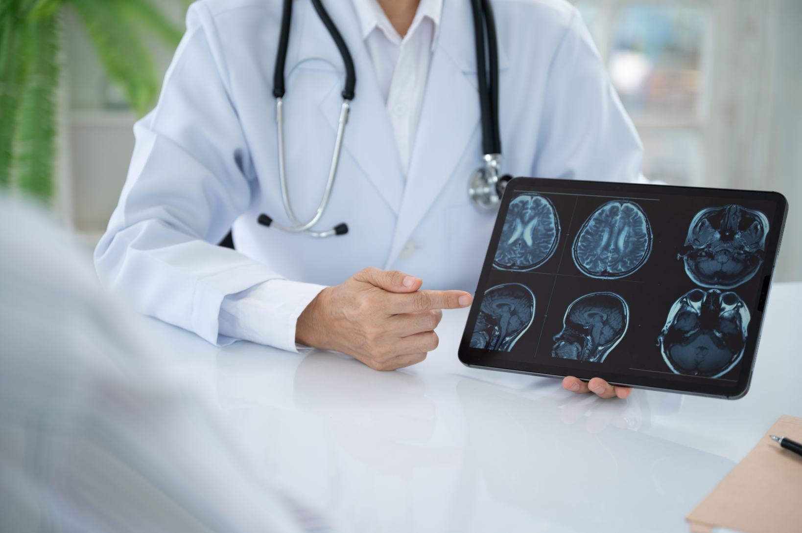 Tumori cerebrali primitivi: caratteristiche cliniche, diagnosi e terapia