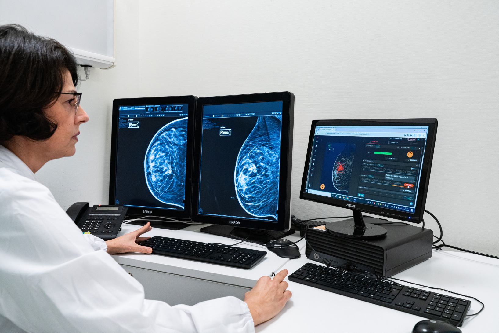 Intelligenza Artificiale per diagnosi precoci del tumore al seno. Humanitas Mater Domini potenzia la Senologia anche nei centri medici del territorio
